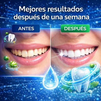 Armadura Líquida Curativa de Caries para Dientes | Promueve un aliento fresco y ayuda a reducir la sensibilidad, Contiene Nano - Hidroxiapatita y Teobromina - IMPERIUM